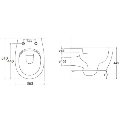 Подвесной унитаз Allen Brau Fantasy 4.11004.20